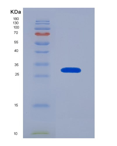 SDS-PAGE analysis of Human MPG (Dna-3-Methyladenine Glycosylase) - Recombinant Protein, CATHuman MPG (Dna-3-Methyladenine Glycosylase) - Recombinant Protein