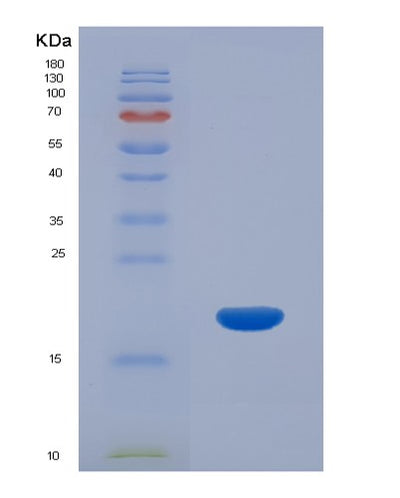 SDS-PAGE analysis of Human CRABP2 (Cellular Retinoic Acid-Binding Protein 2) - Recombinant Protein, CAT# BLT-00682P, showing >85% purity under 15% SDS-PAGE (Reduced)Human CRABP2 (Cellular Retinoic Acid-Binding Protein 2) - Recombinant Protein