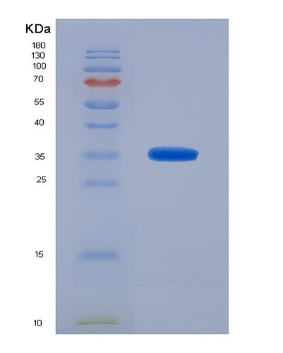 SDS-PAGE analysis of Human TKT (Transketolase) - Recombinant Protein, CAT# BLT-03056P, showing >95% purity under 15% SDS-PAGE (Reduced)Human TKT (Transketolase) - Recombinant Protein