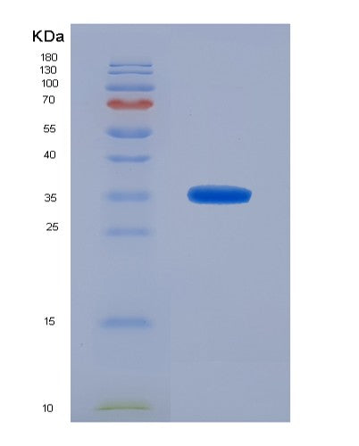 SDS-PAGE analysis of Human TKT (Transketolase) - Recombinant Protein, CATHuman TKT (Transketolase) - Recombinant Protein