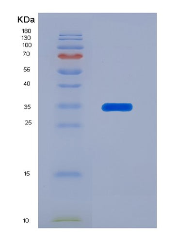 SDS-PAGE analysis of Human SERPINA7 (Thyroxine-Binding Globulin) - Recombinant Protein, CAT# BLT-07600P, showing >90% purity under 15% SDS-PAGE (Reduced)Human SERPINA7 (Thyroxine-Binding Globulin) - Recombinant Protein