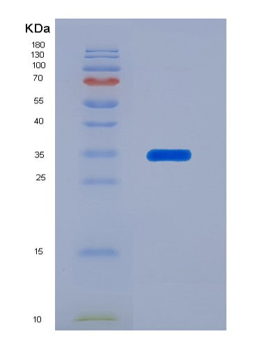 SDS-PAGE analysis of Human SERPINA7 (Thyroxine-Binding Globulin) - Recombinant Protein, CATHuman SERPINA7 (Thyroxine-Binding Globulin) - Recombinant Protein