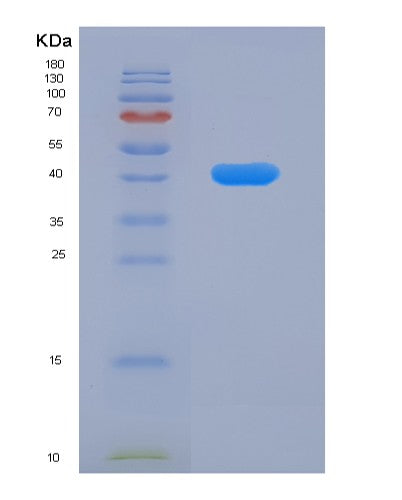 SDS-PAGE analysis of Human SERPINA6 (Corticosteroid-Binding Globulin) - Recombinant Protein, CATHuman SERPINA6 (Corticosteroid-Binding Globulin) - Recombinant Protein