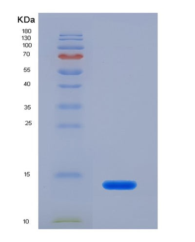 SDS-PAGE analysis of Human COL2A1 (Collagen Alpha-1(Ii) Chain) - Recombinant Protein, CAT# BLT-07602P, showing >90% purity under 15% SDS-PAGE (Reduced)Human COL2A1 (Collagen Alpha-1(Ii) Chain) - Recombinant Protein