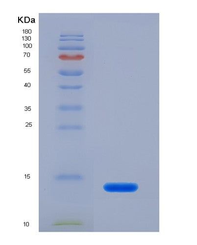 SDS-PAGE analysis of Human COL2A1 (Collagen Alpha-1(Ii) Chain) - Recombinant Protein, CATHuman COL2A1 (Collagen Alpha-1(Ii) Chain) - Recombinant Protein