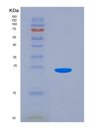SDS-PAGE analysis of Mouse Selp (P-Selectin) - Recombinant Protein, CAT# BLT-07604P, showing >90% purity under 15% SDS-PAGE (Reduced)Mouse Selp (P-Selectin) - Recombinant Protein