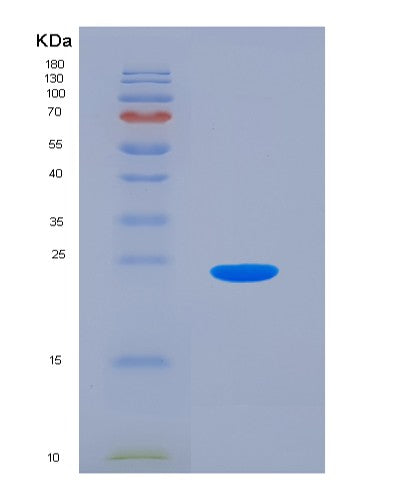 SDS-PAGE analysis of Mouse Selp (P-Selectin) - Recombinant Protein, CATMouse Selp (P-Selectin) - Recombinant Protein