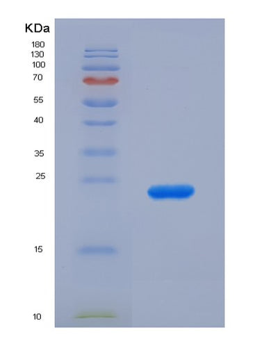 SDS-PAGE analysis of Human SIGLEC12 (Sialic Acid-Binding Ig-Like Lectin 12) - Recombinant Protein, CAT# BLT-07605P, showing >90% purity under 15% SDS-PAGE (Reduced)Human SIGLEC12 (Sialic Acid-Binding Ig-Like Lectin 12) - Recombinant Protein