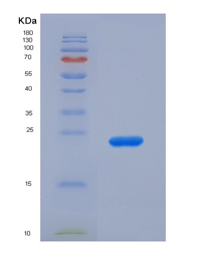 SDS-PAGE analysis of Human SIGLEC12 (Sialic Acid-Binding Ig-Like Lectin 12) - Recombinant Protein, CATHuman SIGLEC12 (Sialic Acid-Binding Ig-Like Lectin 12) - Recombinant Protein