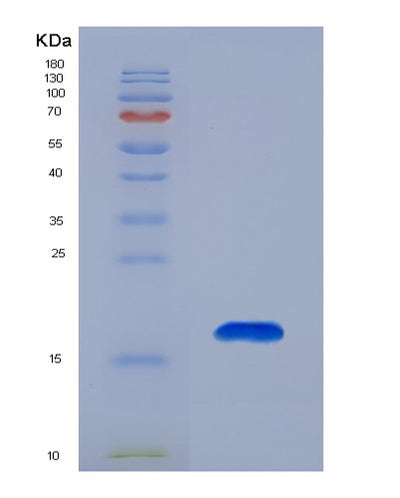 SDS-PAGE analysis of Human LAMA1 (Laminin Subunit Alpha-1) - Recombinant Protein, CAT# BLT-07606P, showing >90% purity under 15% SDS-PAGE (Reduced)Human LAMA1 (Laminin Subunit Alpha-1) - Recombinant Protein