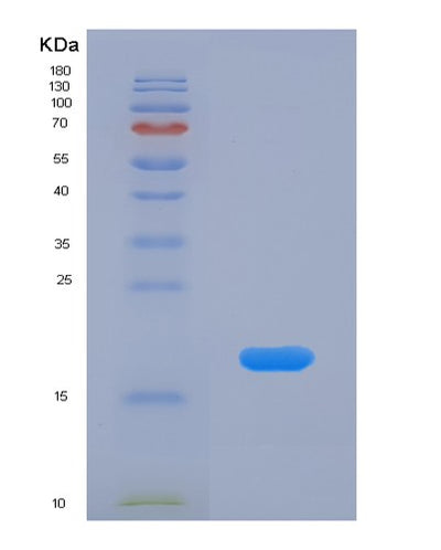 SDS-PAGE analysis of Human CRABP1 (Cellular Retinoic Acid-Binding Protein 1) - Recombinant Protein, CAT# BLT-00681P, showing >90% purity under 15% SDS-PAGE (Reduced)Human CRABP1 (Cellular Retinoic Acid-Binding Protein 1) - Recombinant Protein