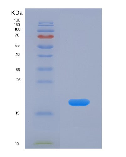 SDS-PAGE analysis of Human CRABP1 (Cellular Retinoic Acid-Binding Protein 1) - Recombinant Protein, CATHuman CRABP1 (Cellular Retinoic Acid-Binding Protein 1) - Recombinant Protein