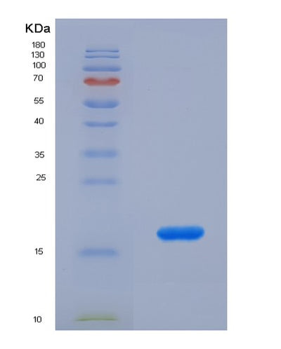 SDS-PAGE analysis of Human CASP2 (Caspase-2) - Recombinant Protein, CAT# BLT-07607P, showing >90% purity under 15% SDS-PAGE (Reduced)Human CASP2 (Caspase-2) - Recombinant Protein
