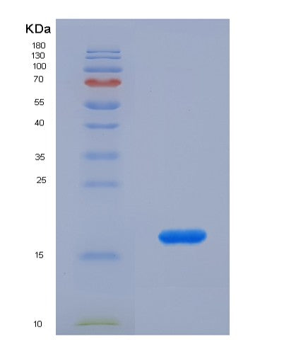 SDS-PAGE analysis of Human CASP2 (Caspase-2) - Recombinant Protein, CATHuman CASP2 (Caspase-2) - Recombinant Protein