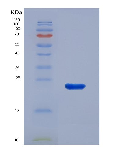 SDS-PAGE analysis of Human ATP5F1D (Atp Synthase Subunit Delta, Mitochondrial) - Recombinant Protein, CATHuman ATP5F1D (Atp Synthase Subunit Delta, Mitochondrial) - Recombinant Protein