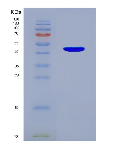 SDS-PAGE analysis of Human SFTPC (Surfactant Protein C) - Recombinant Protein, CAT# BLT-07609P, showing >90% purity under 15% SDS-PAGE (Reduced)Human SFTPC (Surfactant Protein C) - Recombinant Protein