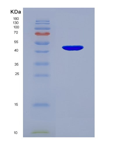 SDS-PAGE analysis of Human SFTPC (Surfactant Protein C) - Recombinant Protein, CATHuman SFTPC (Surfactant Protein C) - Recombinant Protein