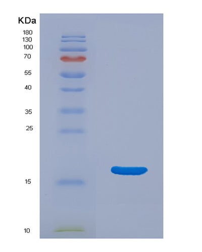 SDS-PAGE analysis of Mouse Uba52 (Ubiquitin-Ribosomal Protein El40 Fusion Protein) - Recombinant Protein, CAT# BLT-07610P, showing >90% purity under 15% SDS-PAGE (Reduced)Mouse Uba52 (Ubiquitin-Ribosomal Protein El40 Fusion Protein) - Recombinant Protein