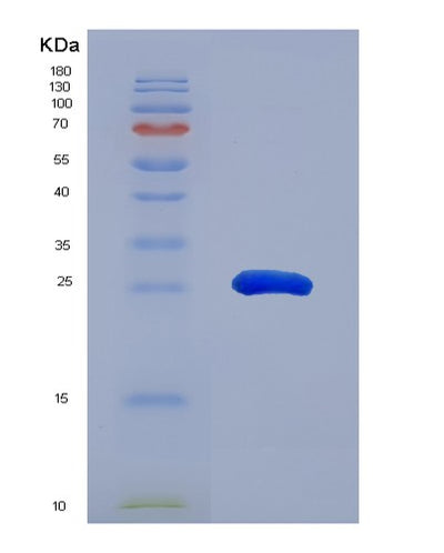 SDS-PAGE analysis of Human CCND2 (G1/S-Specific Cyclin-D2) - Recombinant Protein, CAT# BLT-00458P, showing >90% purity under 15% SDS-PAGE (Reduced)Human CCND2 (G1/S-Specific Cyclin-D2) - Recombinant Protein