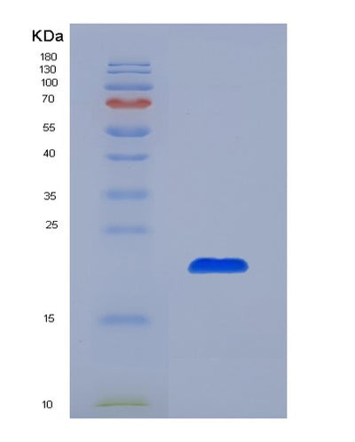 SDS-PAGE analysis of Human CDC25A (M-Phase Inducer Phosphatase 1) - Recombinant Protein, CAT# BLT-00528P, showing >85% purity under 15% SDS-PAGE (Reduced)Human CDC25A (M-Phase Inducer Phosphatase 1) - Recombinant Protein