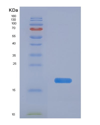 SDS-PAGE analysis of Human PPIF (Peptidyl-Prolyl Cis-Trans Isomerase F, Mitochondrial) - Recombinant Protein, CAT# BLT-00789P, showing >85% purity under 15% SDS-PAGE (Reduced)Human PPIF (Peptidyl-Prolyl Cis-Trans Isomerase F, Mitochondrial) - Recombinant Protein