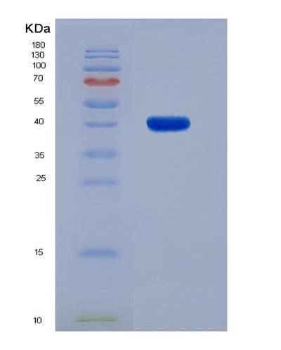 SDS-PAGE analysis of Human ADSL (Adenylosuccinate Lyase) - Recombinant Protein, CAT# BLT-00075P, showing >90% purity under 15% SDS-PAGE (Reduced)Human ADSL (Adenylosuccinate Lyase) - Recombinant Protein