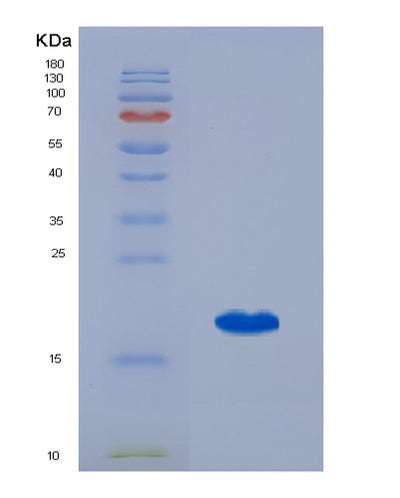 SDS-PAGE analysis of Human SRI (Sorcin) - Recombinant Protein, CAT# BLT-02868P, showing >95% purity under 15% SDS-PAGE (Reduced)Human SRI (Sorcin) - Recombinant Protein