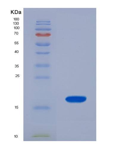 SDS-PAGE analysis of Human UBA52 (Ubiquitin-Ribosomal Protein El40 Fusion Protein) - Recombinant Protein, CAT# BLT-07613P, showing >90% purity under 15% SDS-PAGE (Reduced)Human UBA52 (Ubiquitin-Ribosomal Protein El40 Fusion Protein) - Recombinant Protein