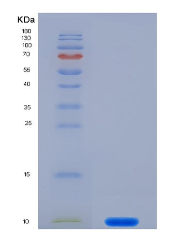 SDS-PAGE analysis of Human S100A7 (Protein S100-A7) - Recombinant Protein, CAT# BLT-02677P, showing >85% purity under 15% SDS-PAGE (Reduced)Human S100A7 (Protein S100-A7) - Recombinant Protein