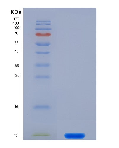 SDS-PAGE analysis of Human S100A7 (Protein S100-A7) - Recombinant Protein, CATHuman S100A7 (Protein S100-A7) - Recombinant Protein