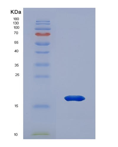 SDS-PAGE analysis of Human PRDX2 (Peroxiredoxin-2) - Recombinant Protein, CAT# BLT-02213P, showing >85% purity under 15% SDS-PAGE (Reduced)Human PRDX2 (Peroxiredoxin-2) - Recombinant Protein