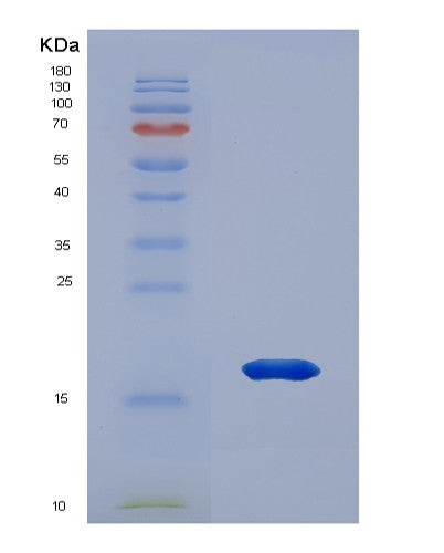 SDS-PAGE analysis of Human PRDX2 (Peroxiredoxin-2) - Recombinant Protein, CATHuman PRDX2 (Peroxiredoxin-2) - Recombinant Protein