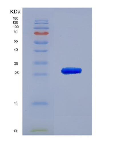 SDS-PAGE analysis of Human CHRNA3 (Neuronal Acetylcholine Receptor Subunit Alpha-3) - Recombinant Protein, CAT# BLT-00599P, showing >85% purity under 15% SDS-PAGE (Reduced)Human CHRNA3 (Neuronal Acetylcholine Receptor Subunit Alpha-3) - Recombinant Protein