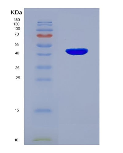 SDS-PAGE analysis of Human TNNC1 (Troponin C, Slow Skeletal And Cardiac Muscles) - Recombinant Protein, CAT# BLT-03135P, showing >90% purity under 15% SDS-PAGE (Reduced)Human TNNC1 (Troponin C, Slow Skeletal And Cardiac Muscles) - Recombinant Protein