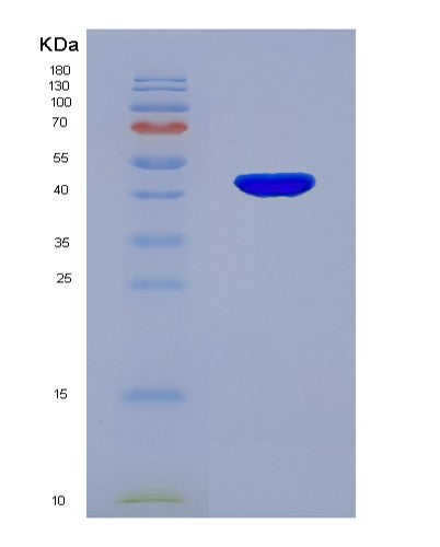 SDS-PAGE analysis of Human TNNC1 (Troponin C, Slow Skeletal And Cardiac Muscles) - Recombinant Protein, CATHuman TNNC1 (Troponin C, Slow Skeletal And Cardiac Muscles) - Recombinant Protein