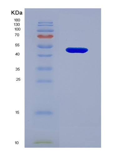 SDS-PAGE analysis of Human TNNC1 (Troponin C, Slow Skeletal And Cardiac Muscles) - Recombinant Protein, CAT# BLT-03093P, showing >95% purity under 15% SDS-PAGE (Reduced)Human TNNC1 (Troponin C, Slow Skeletal And Cardiac Muscles) - Recombinant Protein