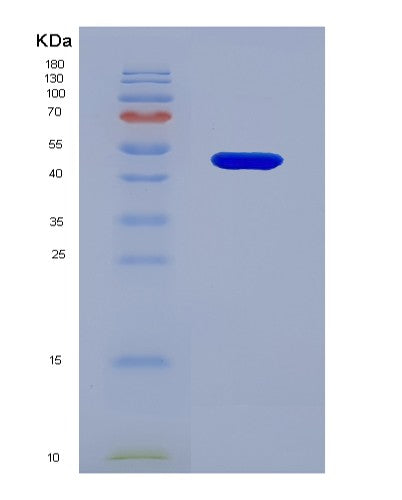 SDS-PAGE analysis of Human TNNC1 (Troponin C, Slow Skeletal And Cardiac Muscles) - Recombinant Protein, CATHuman TNNC1 (Troponin C, Slow Skeletal And Cardiac Muscles) - Recombinant Protein