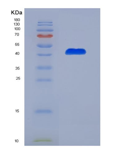 SDS-PAGE analysis of Human CD70 (Cd70 Antigen) - Recombinant Protein, CAT# BLT-00515P, showing >90% purity under 15% SDS-PAGE (Reduced)Human CD70 (Cd70 Antigen) - Recombinant Protein