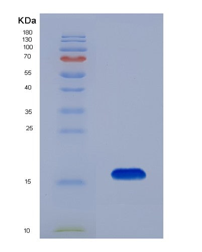 SDS-PAGE analysis of Human BTC (Probetacellulin) - Recombinant Protein, CATHuman BTC (Probetacellulin) - Recombinant Protein