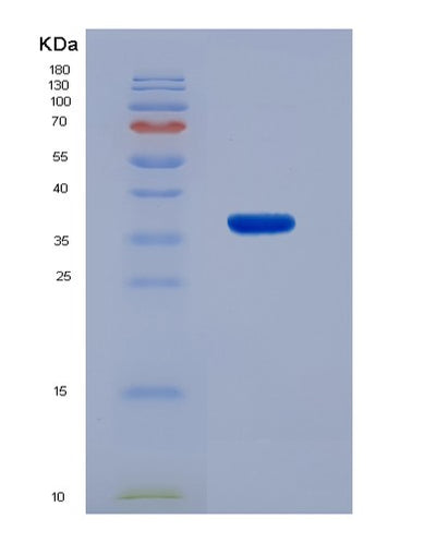 SDS-PAGE analysis of Human CA8 (Carbonic Anhydrase-Related Protein) - Recombinant Protein, CAT# BLT-00380P, showing >85% purity under 15% SDS-PAGE (Reduced)Human CA8 (Carbonic Anhydrase-Related Protein) - Recombinant Protein