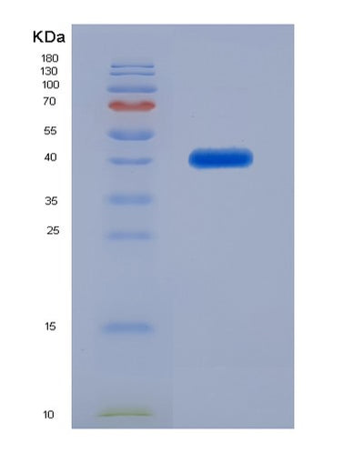 SDS-PAGE analysis of Human SFTPD (Pulmonary Surfactant-Associated Protein D) - Recombinant Protein, CAT# BLT-02760P, showing >85% purity under 15% SDS-PAGE (Reduced)Human SFTPD (Pulmonary Surfactant-Associated Protein D) - Recombinant Protein