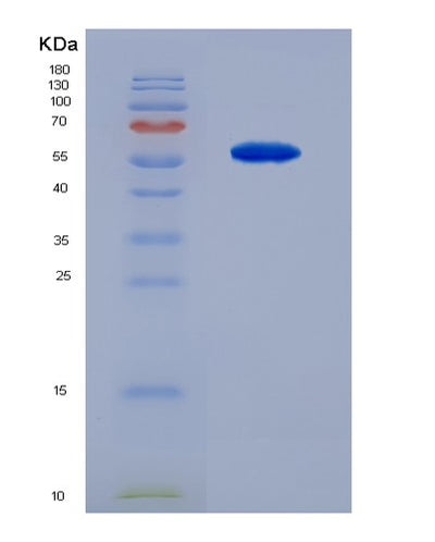 SDS-PAGE analysis of Human SPR (Sepiapterin Reductase) - Recombinant Protein, CAT# BLT-02729P, showing >90% purity under 15% SDS-PAGE (Reduced)Human SPR (Sepiapterin Reductase) - Recombinant Protein