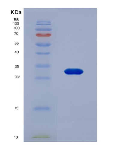 SDS-PAGE analysis of Human SAA4 (Serum Amyloid A-4 Protein) - Recombinant Protein, CAT# BLT-02689P, showing >85% purity under 15% SDS-PAGE (Reduced)Human SAA4 (Serum Amyloid A-4 Protein) - Recombinant Protein