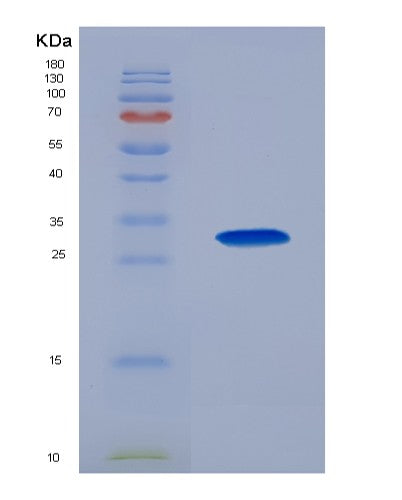 SDS-PAGE analysis of Human GCK (Hexokinase-4) - Recombinant Protein, CATHuman GCK (Hexokinase-4) - Recombinant Protein