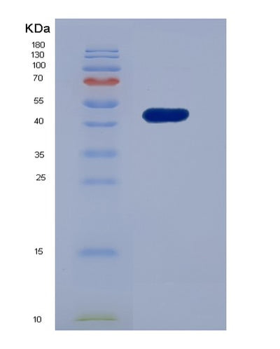SDS-PAGE analysis of Mouse Prdx1 (Peroxiredoxin-1) - Recombinant Protein, CAT# BLT-05731P, showing >85% purity under 15% SDS-PAGE (Reduced)Mouse Prdx1 (Peroxiredoxin-1) - Recombinant Protein