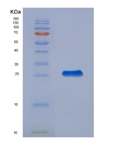 SDS-PAGE analysis of Human CHI3L1 (Chitinase-3-Like Protein 1) - Recombinant Protein, CAT# BLT-00586P, showing >90% purity under 15% SDS-PAGE (Reduced)Human CHI3L1 (Chitinase-3-Like Protein 1) - Recombinant Protein