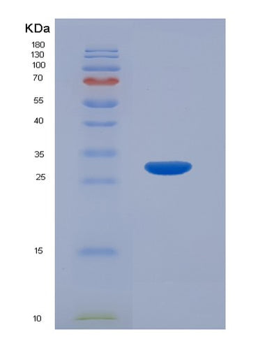 SDS-PAGE analysis of Human MAP2K2 (Dual Specificity Mitogen-Activated Protein Kinase Kinase 2) - Recombinant Protein, CAT# BLT-01784P, showing >90% purity under 15% SDS-PAGE (Reduced)Human MAP2K2 (Dual Specificity Mitogen-Activated Protein Kinase Kinase 2) - Recombinant Protein