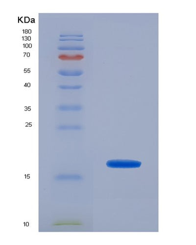 SDS-PAGE analysis of Human SELP (P-Selectin) - Recombinant Protein, CAT# BLT-07614P, showing >90% purity under 15% SDS-PAGE (Reduced)Human SELP (P-Selectin) - Recombinant Protein