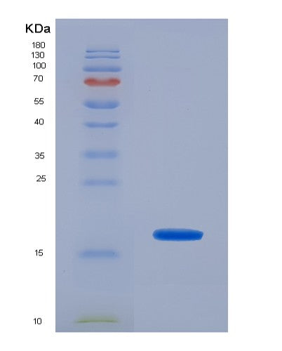 SDS-PAGE analysis of Human SELP (P-Selectin) - Recombinant Protein, CATHuman SELP (P-Selectin) - Recombinant Protein