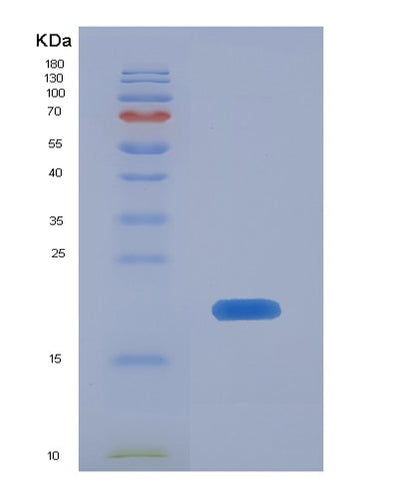 SDS-PAGE analysis of Human LTBR (Tumor Necrosis Factor Receptor Superfamily Member 3) - Recombinant Protein, CAT# BLT-08387P showing >85% purity under 15% SDS-PAGE (Reduced)Human LTBR (Tumor Necrosis Factor Receptor Superfamily Member 3) - Recombinant Protein